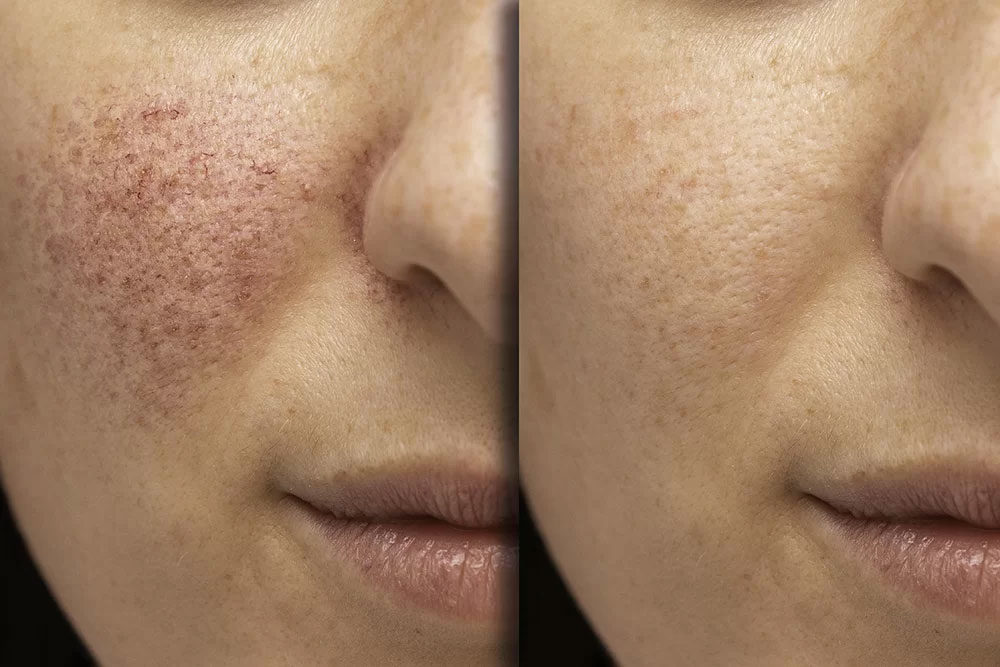 el panthenol la vitamina de la belleza